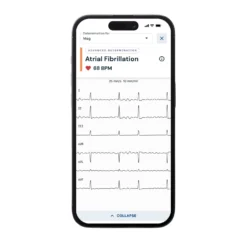 ALIVECOR® KardiaMobile®