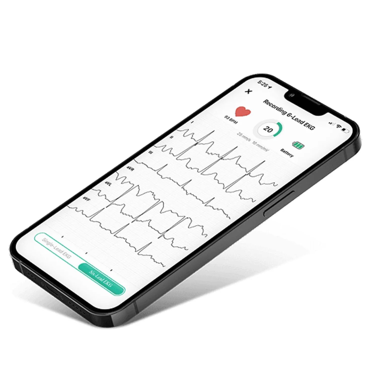 ALIVECOR® KardiaMobile®