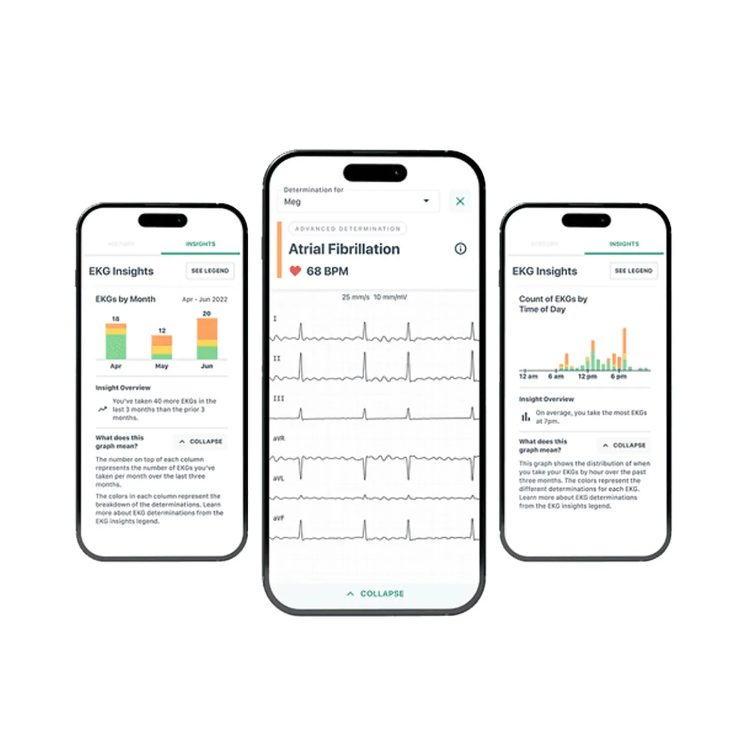 ALIVECOR® KI-Mitgliedschaft