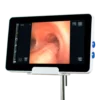 Ambu® aView™ 2 Advance