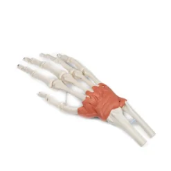 Bandapparat des Handgelenks
