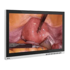 BenQ 26" Full-HD medizinischer Monitor