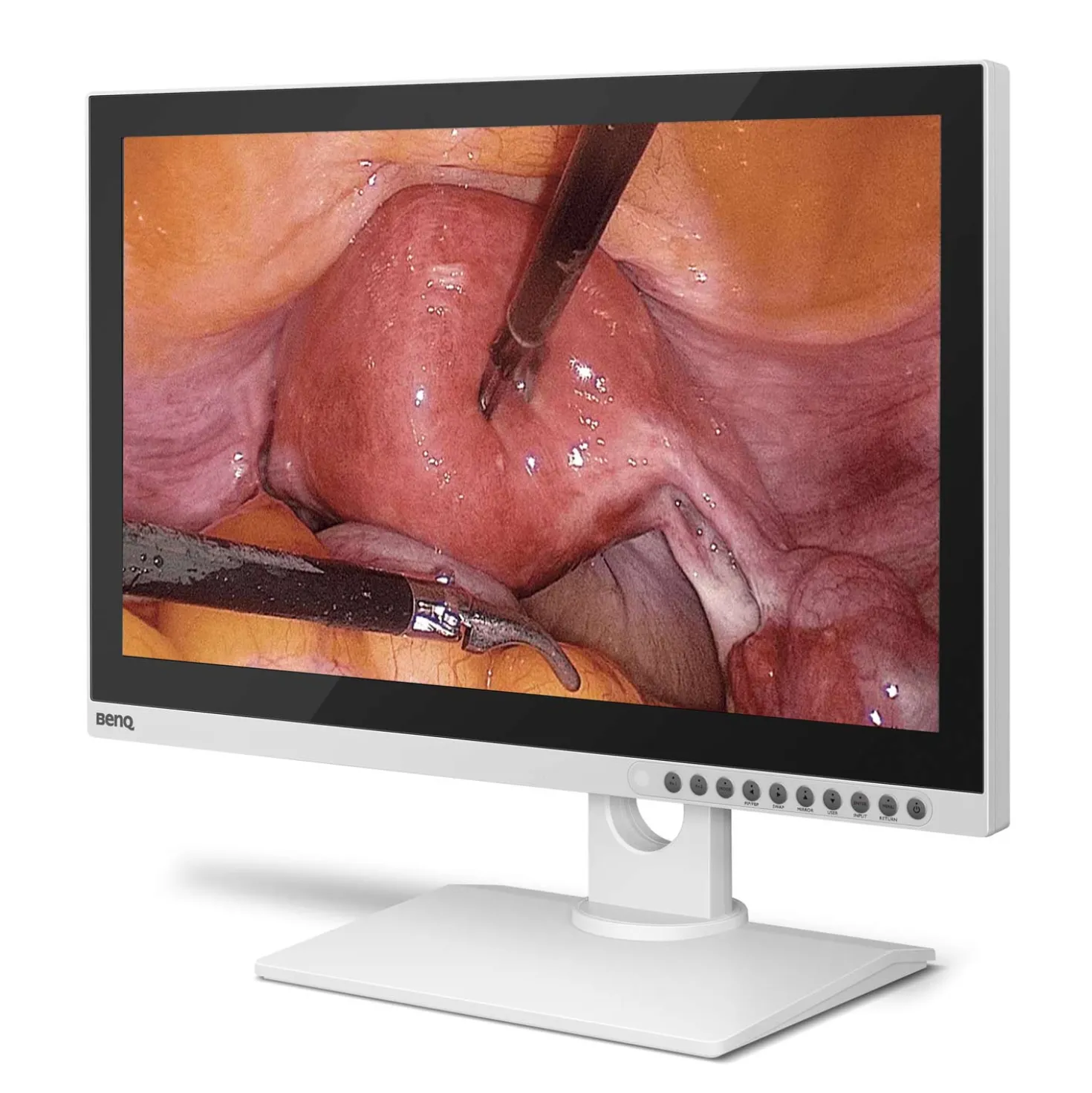 BenQ 26" Full-HD medizinischer Monitor