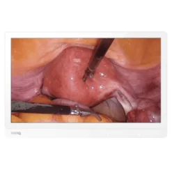 BenQ 27" 4K Ultra-HD Chirurgie-Monitor