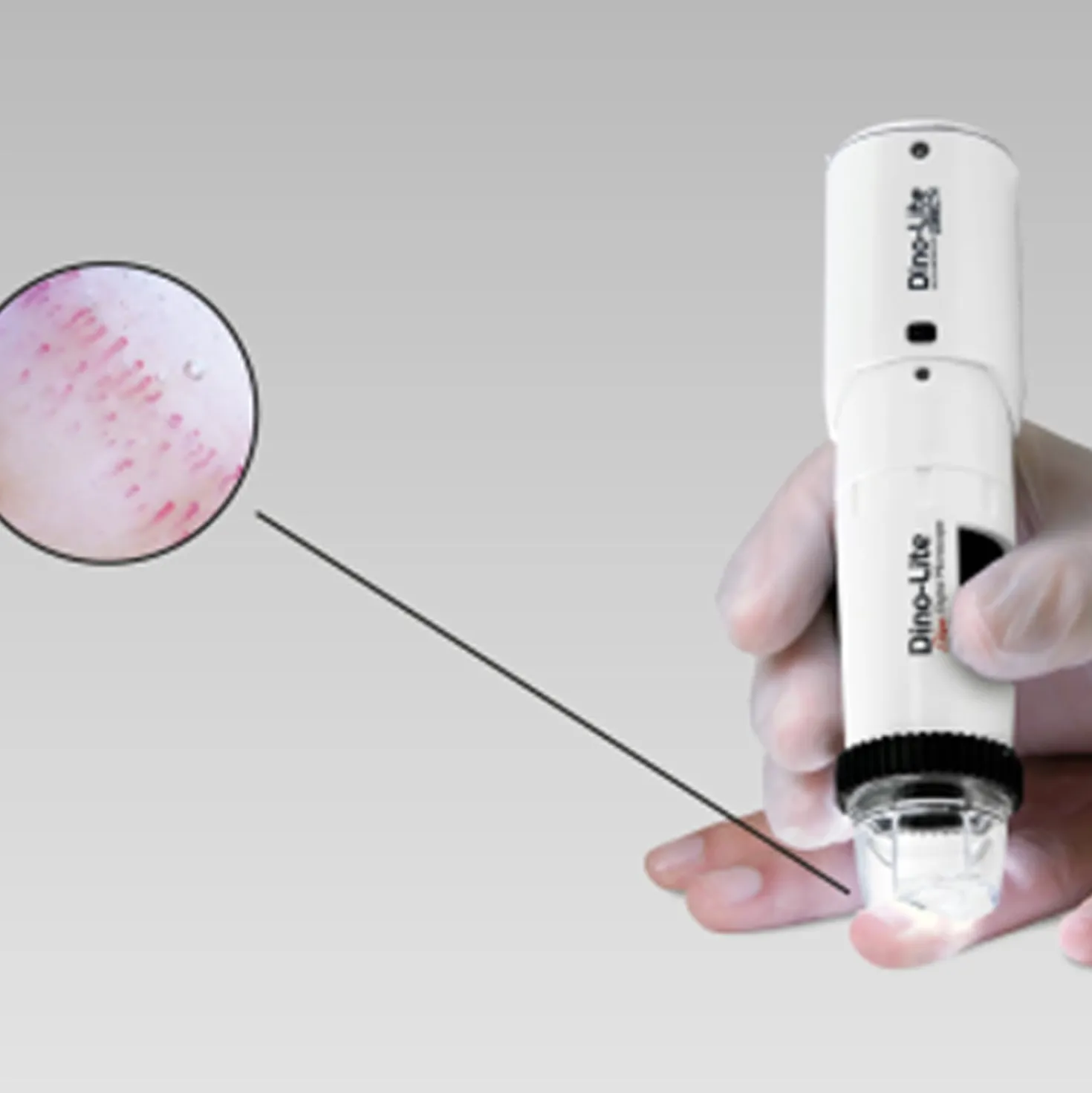 CapillaryScope 500 Pro (kabellos)