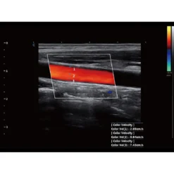 CBit9 Farbdoppler-Ultraschallsystem