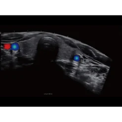 CBit9 Farbdoppler-Ultraschallsystem