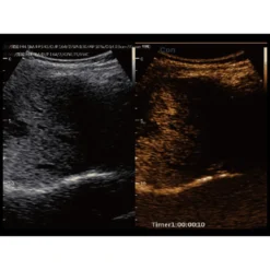 CBit9 Farbdoppler-Ultraschallsystem