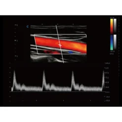 CBit9 Farbdoppler-Ultraschallsystem