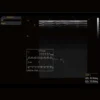 CBit 4 Ultraschallgerät
