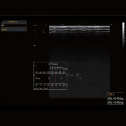 CBit 4 Ultraschallgerät