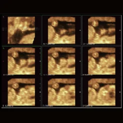 CBit 4 Ultraschallgerät