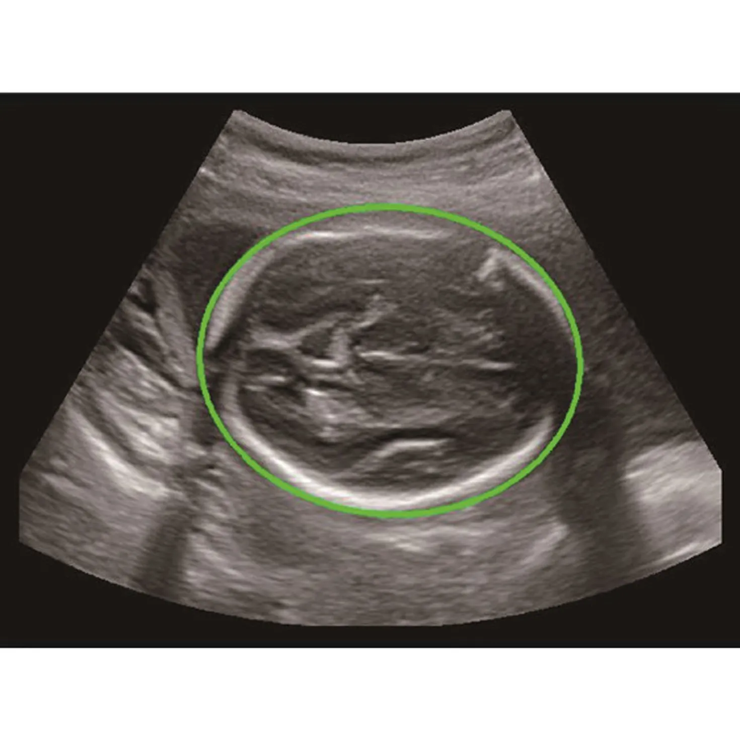 CBit6 Ultraschallgerät