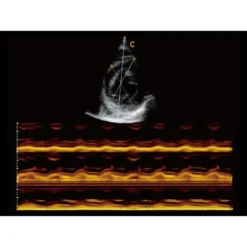 CBit6 Ultraschallgerät