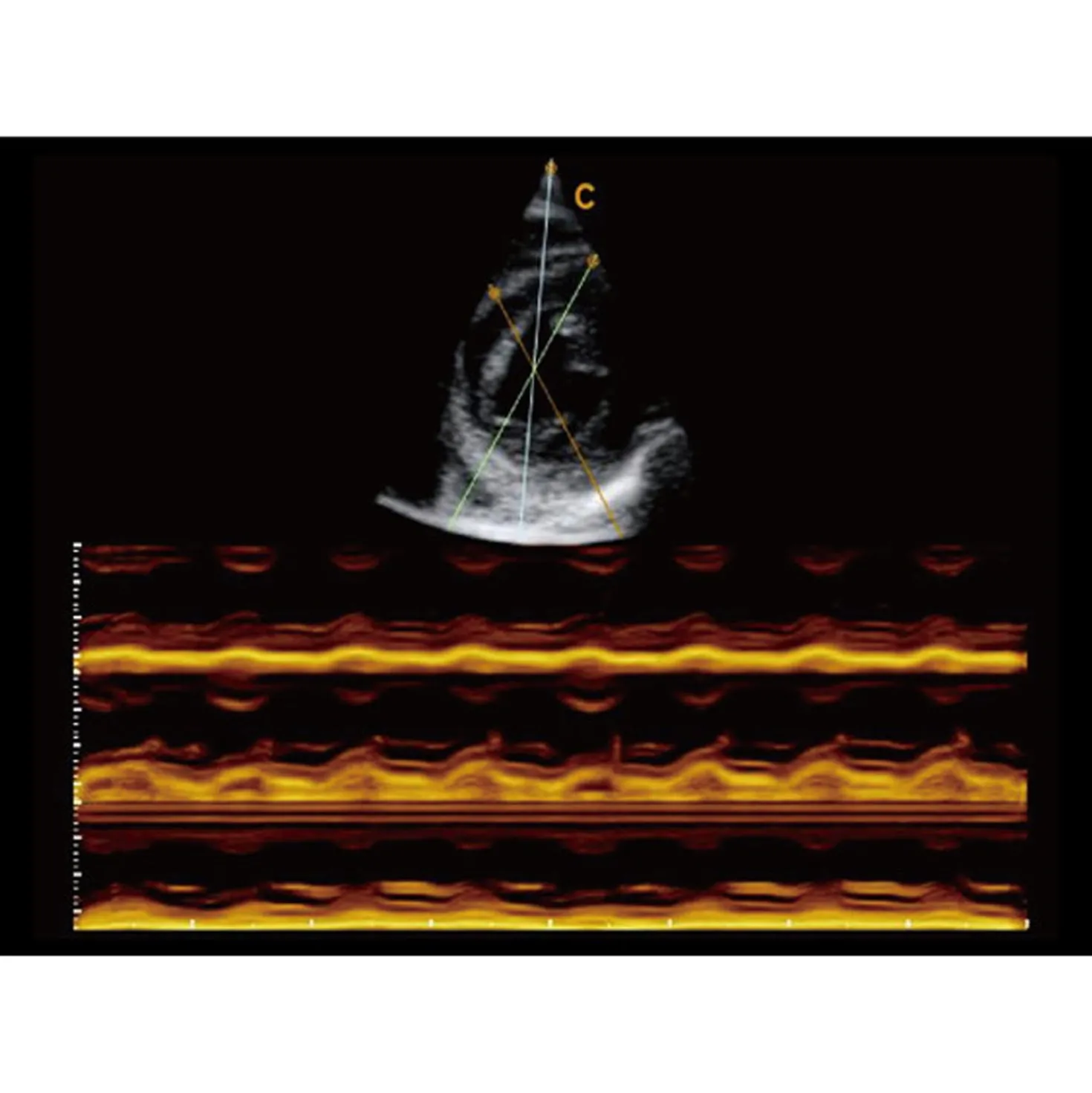 CBit6 Ultraschallgerät