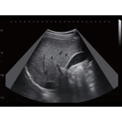 CBit6 Ultraschallgerät