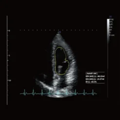 CBit 10 Ultraschallsystem