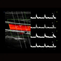 CBit 10 Ultraschallsystem