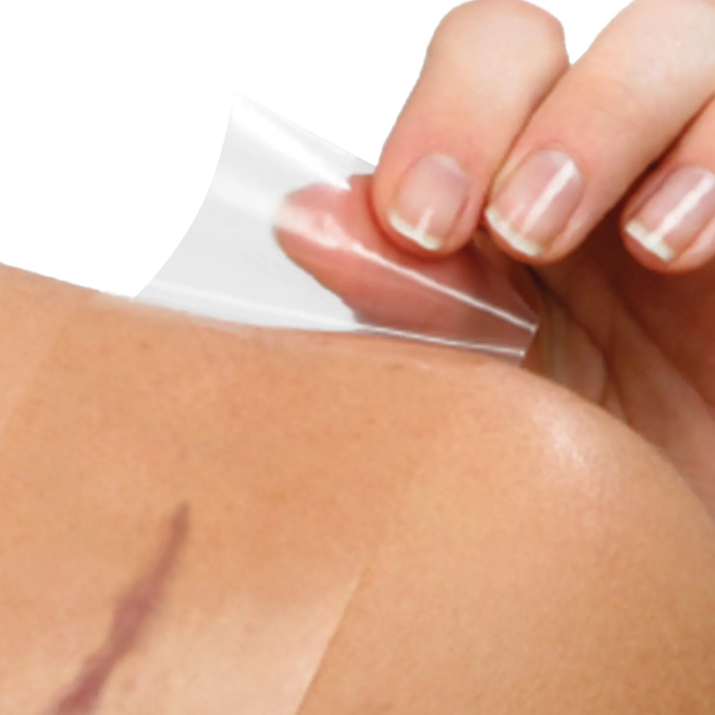 Cerederm® Silikonpflaster