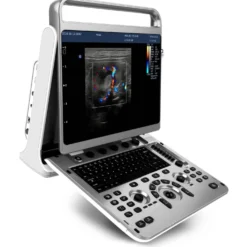 Chison EBit 30