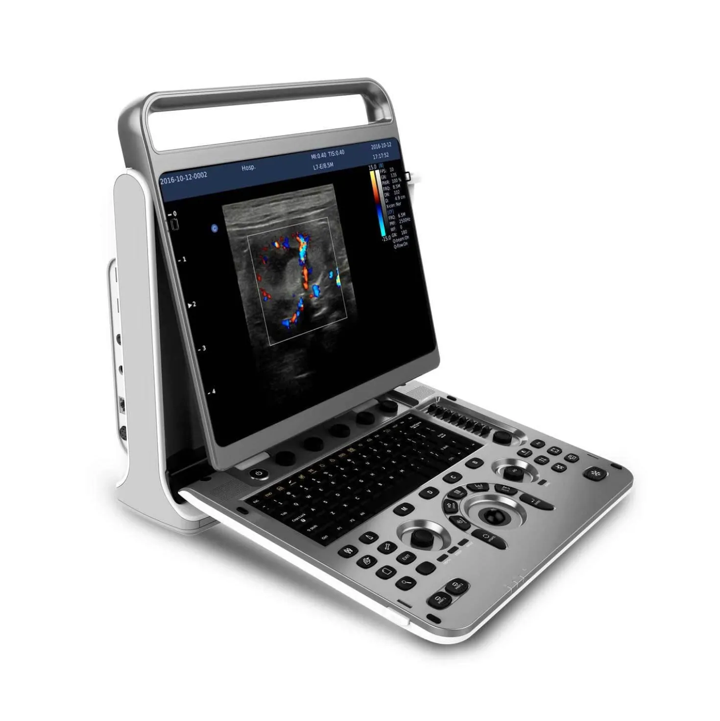 Chison EBit 30