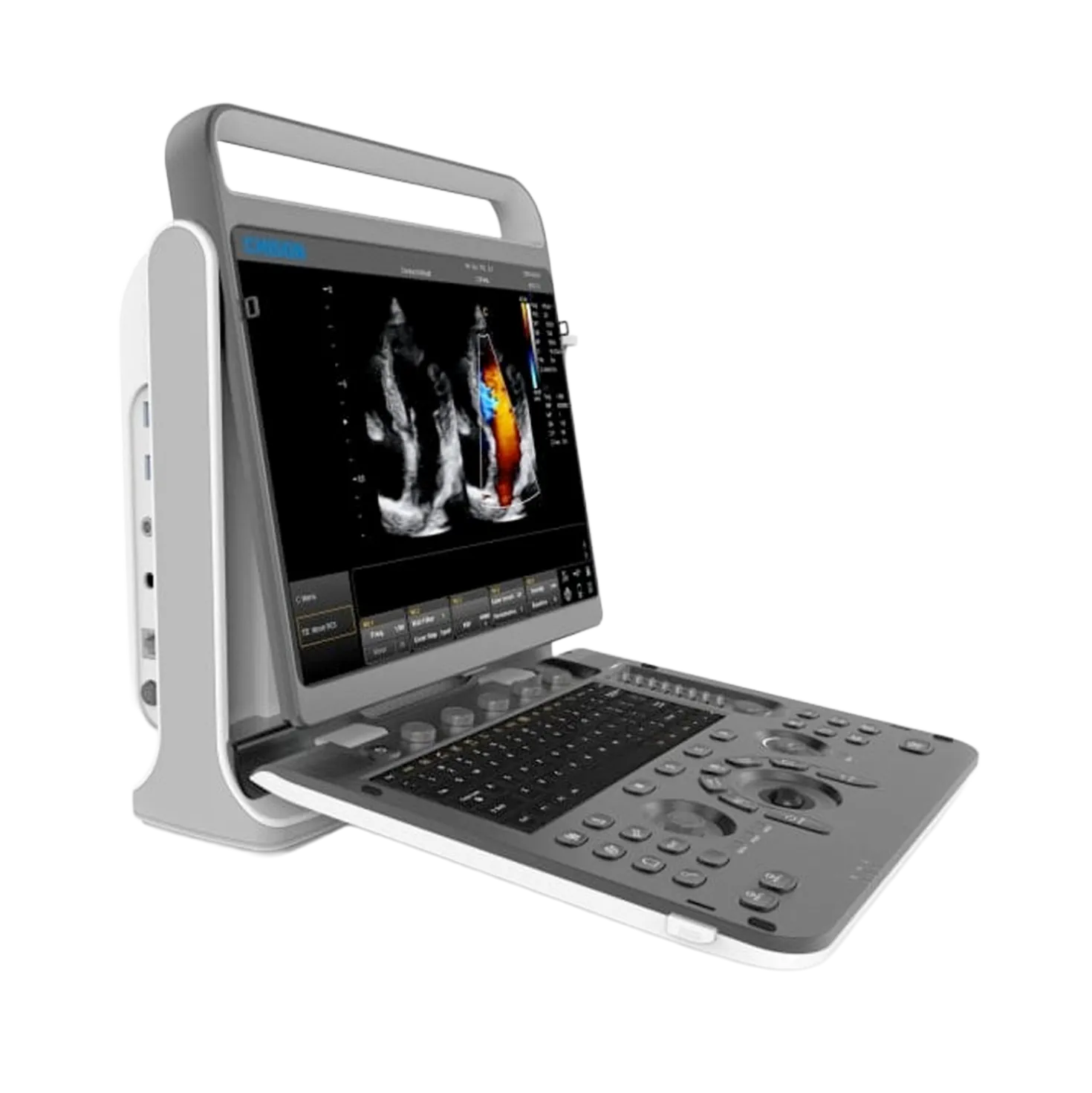 Chison EBit 60 Ultraschallsystem