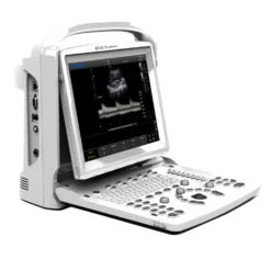CHISON ECO3 Expert Ultraschallgerät