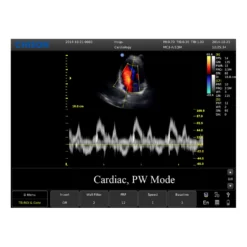 CHISON ECO5 Ultraschallgerät mit Farbdoppler