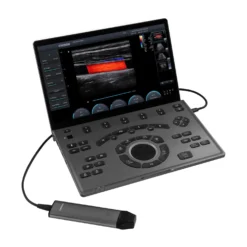 CHISON SonoAir 30