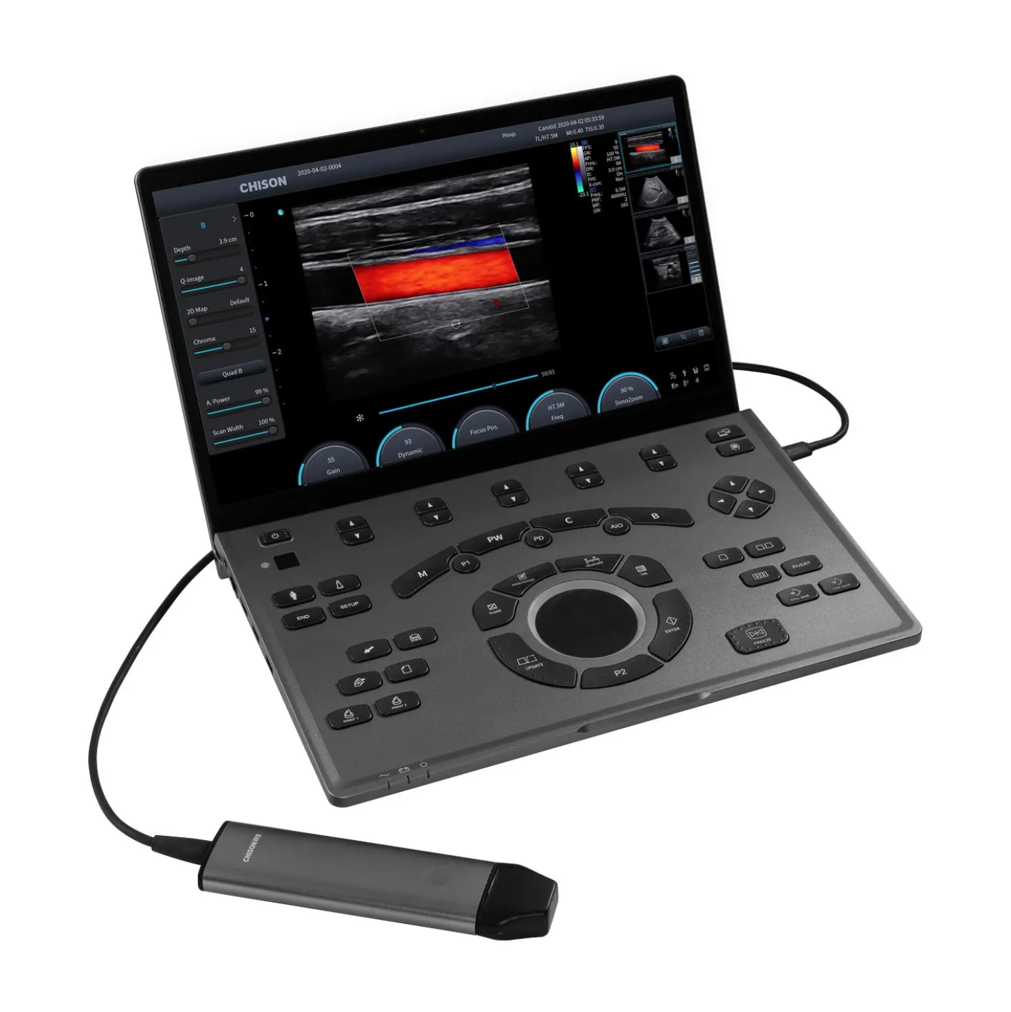 CHISON SonoAir 30
