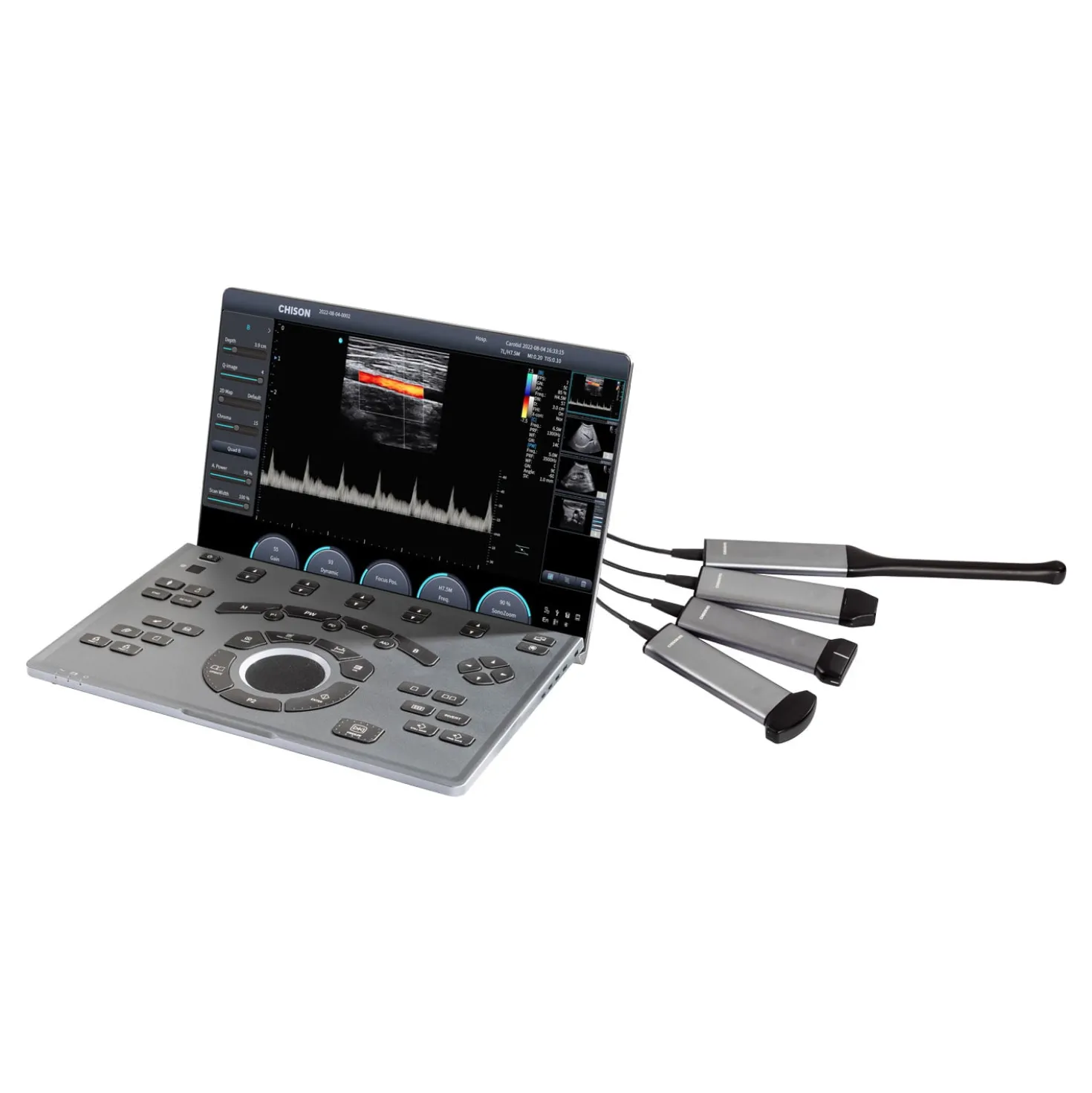 CHISON SonoAir 30
