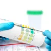 Combur 4 Test N, 50 Urinteststreifen