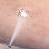Cryoalfa LUX DermMix