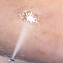 Cryoalfa SUPER