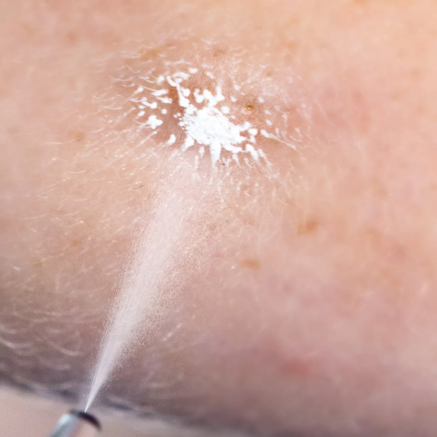 Cryoalfa SUPER
