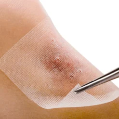 Cuticell® Salbenverband