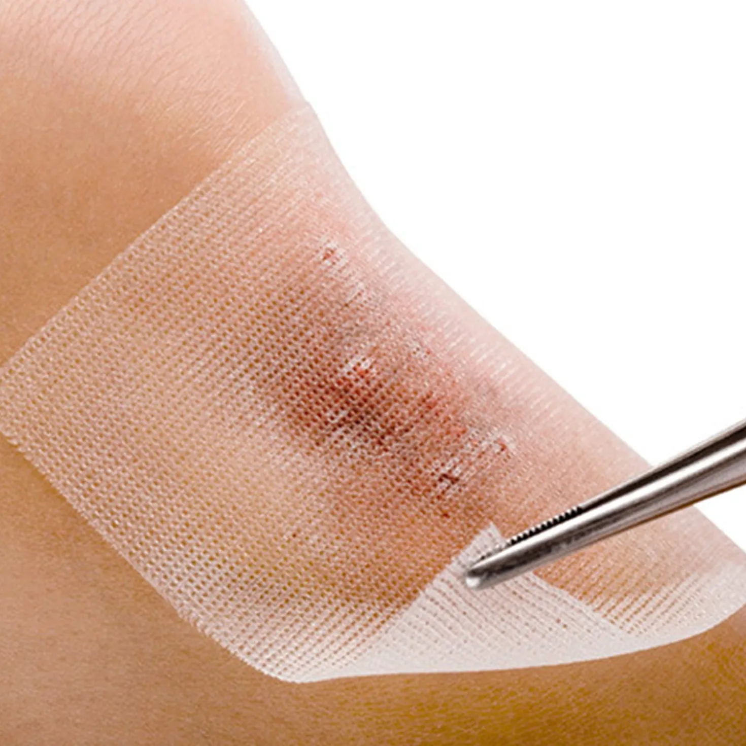 Cuticell® Salbenverband