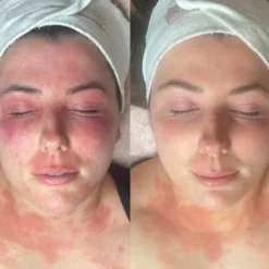 Dermalux TRI-WAVE MD