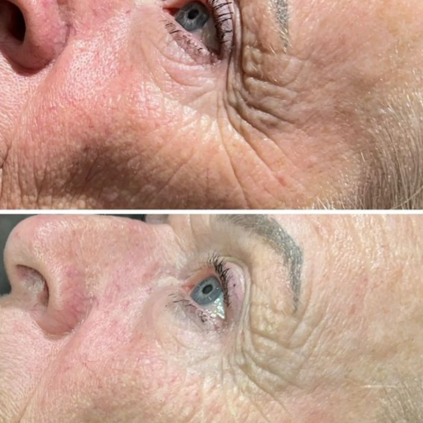 Dermalux TRI-WAVE MD