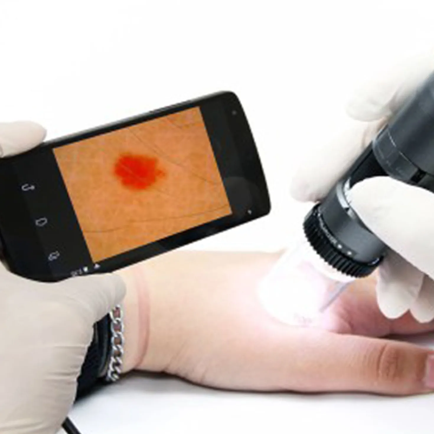 DermaScope® Polarizer