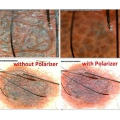 DermaScope® Polarizer HR 200x
