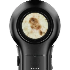 DermLite DL5 Plus