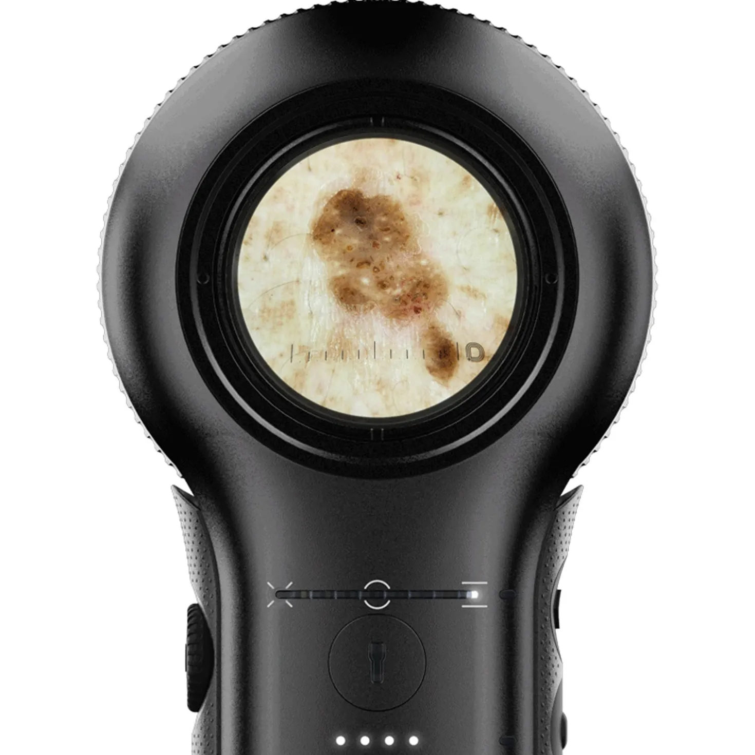DermLite DL5 Plus