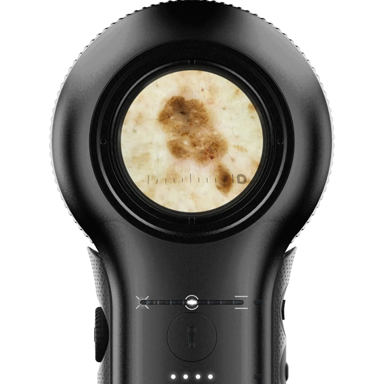DermLite DL5 Plus