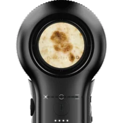 DermLite DL5 Plus