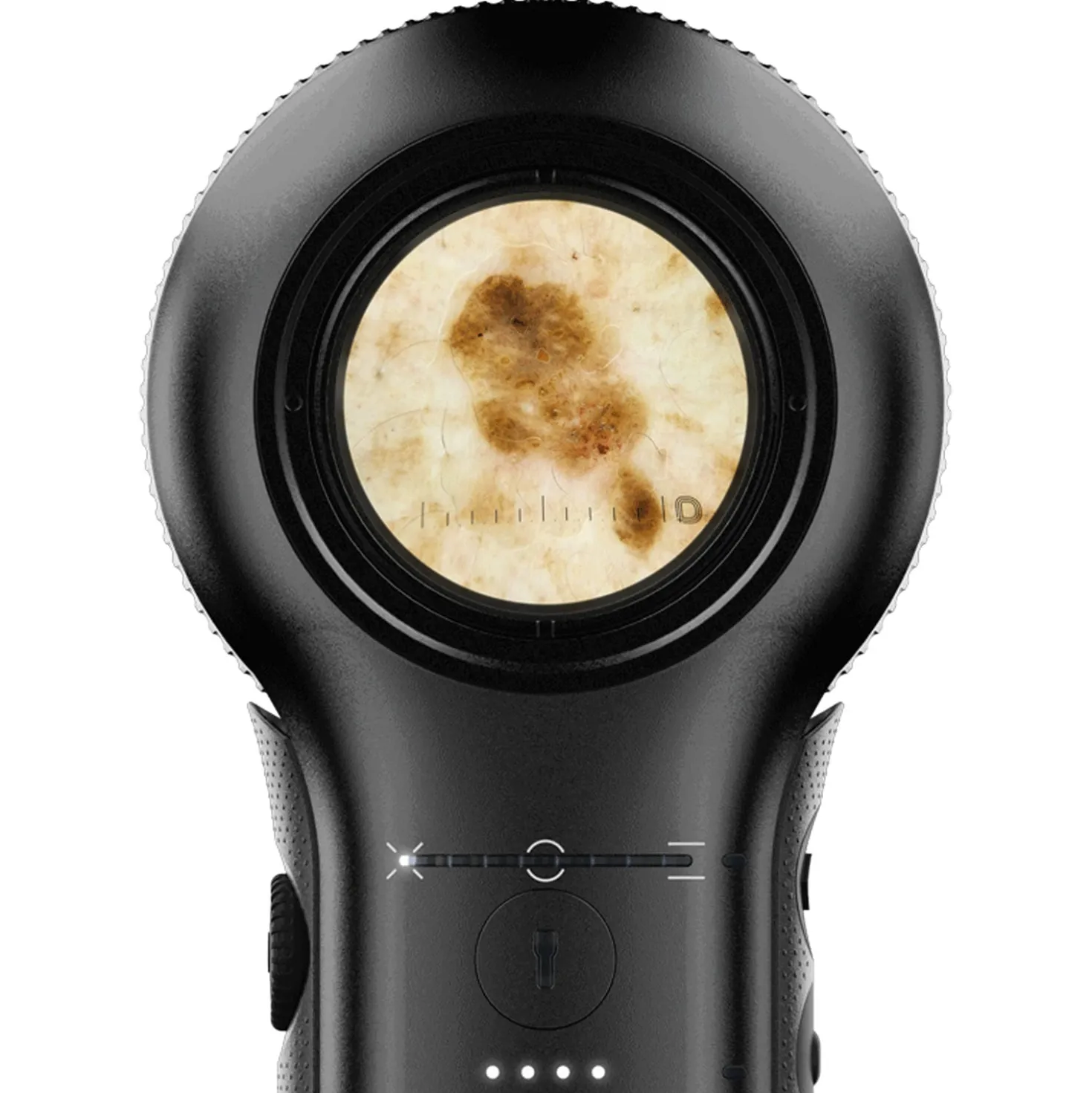 DermLite DL5 Plus