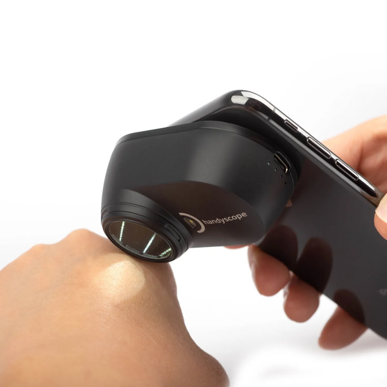 DermLite Handyscope