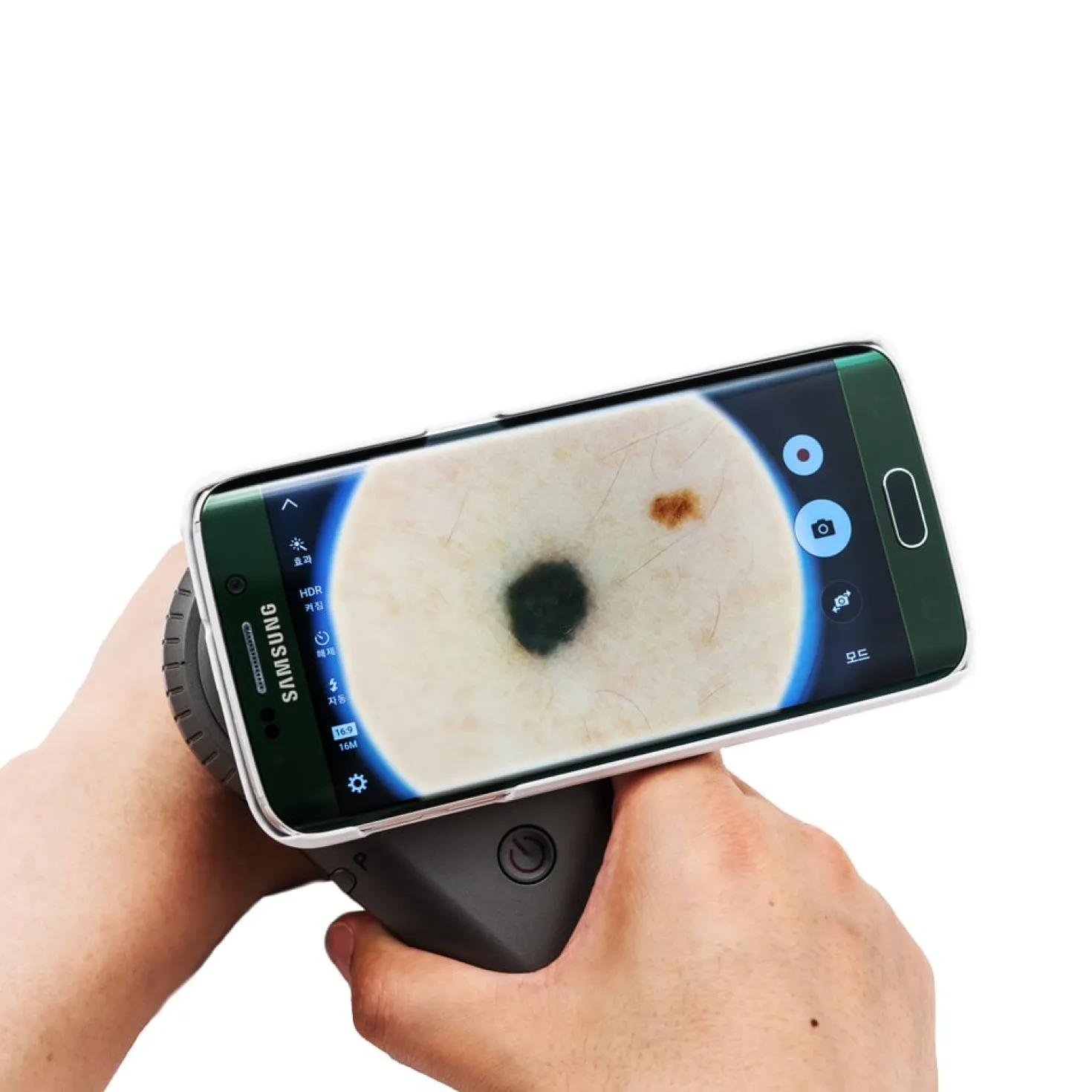 DermoScan Smartphone-Adapter