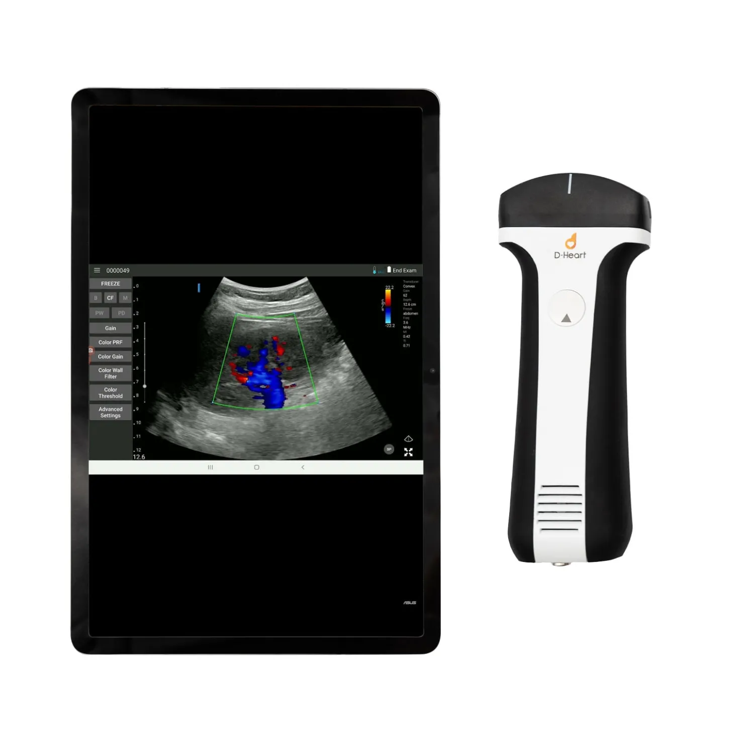 D-Heart handheld Ultraschallgerät
