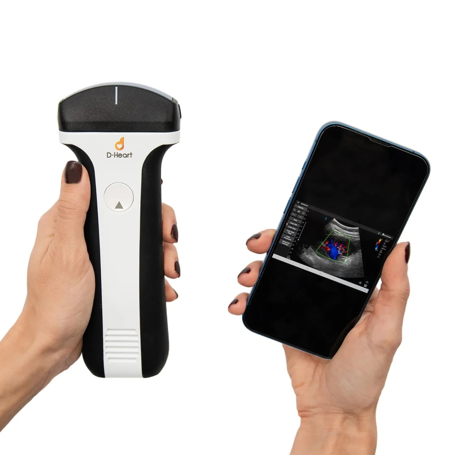 D-Heart handheld Ultraschallgerät